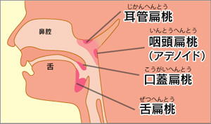 扁桃腺の種類